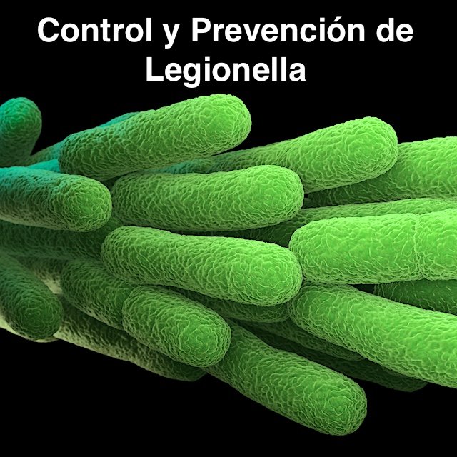 Legionella Lwegionelosis cadiz desintesa